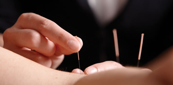 Acupuntura China: Revisión General - Instituto de Medicina Tradicional